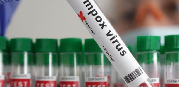 Un cas de Mpox détecté en Gambie, le Sénégal en alerte