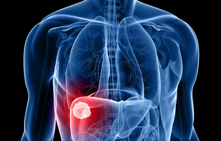 Cancer du foie : 5 symptômes à ne pas négliger